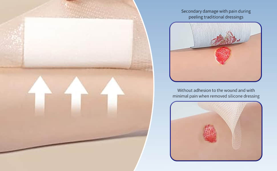 Advanced Silicone Foam Dressing Advanced Silicone Foam Dressing
