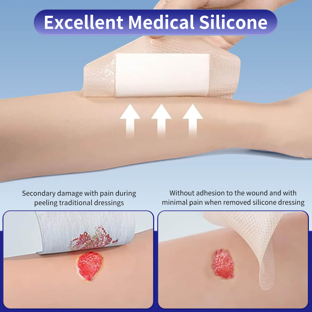 Advanced Silicone Foam Dressing