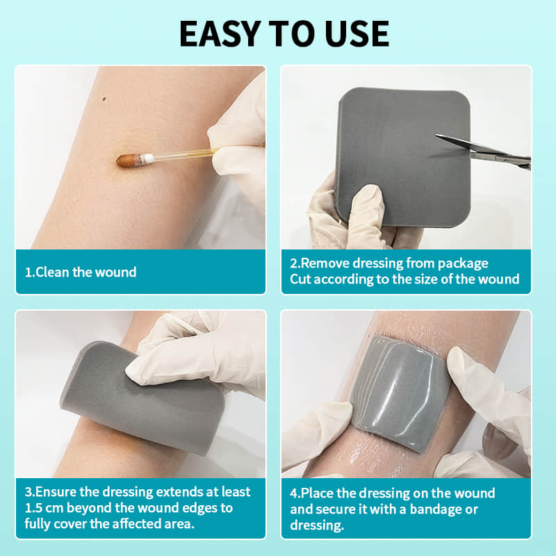 Advanced Silver Wound Dressing