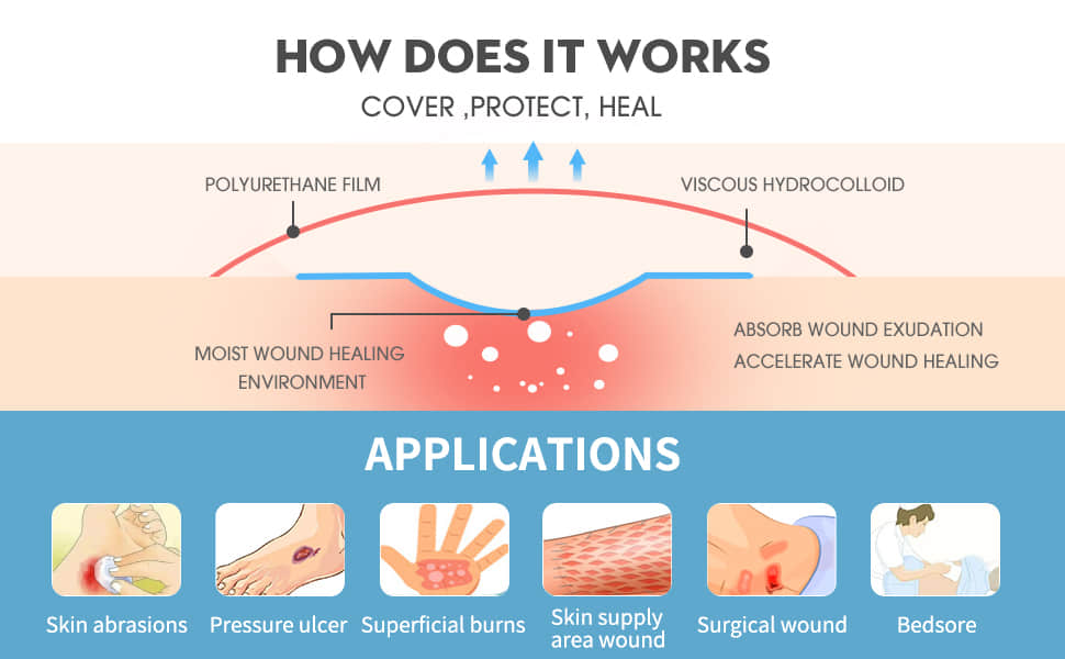 Hydrocolloid Wound Dressing Hydrocolloid Wound Dressing