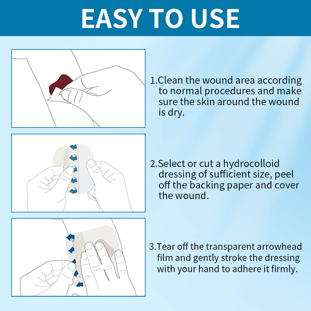 Hydrocolloid Wound Dressing