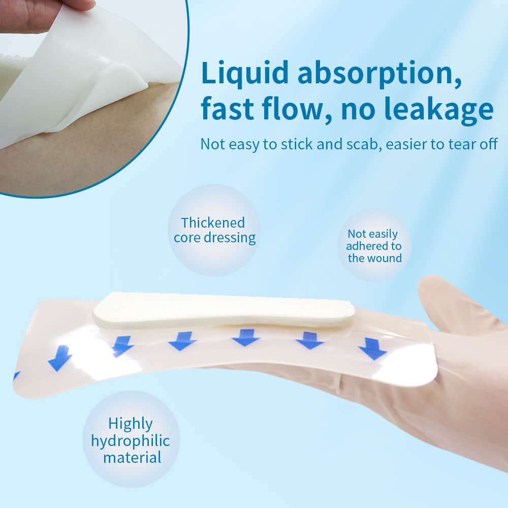 Hydrocolloid Wound Dressing